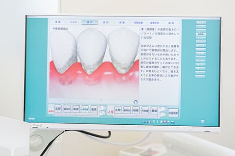 説明用モニター
