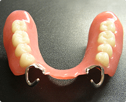 レジン床（クラスプ付）