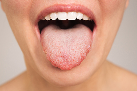 口腔がんの早期発見と診断