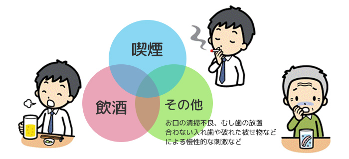 口腔がんの危険因子